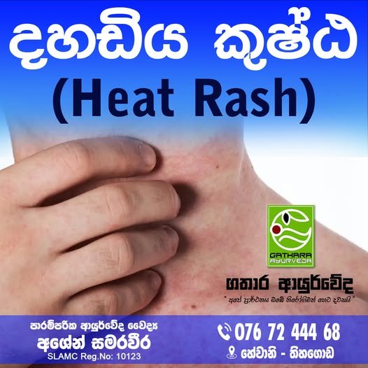 HEAT RASH / SWEAT RASH